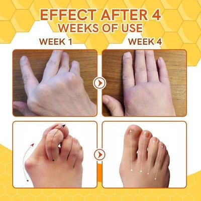 Bee Venom Joint and Bone Therapy Spray |⭐⭐⭐⭐⭐ (4.9/5)- Buy 1 Get 1 Free 🔥